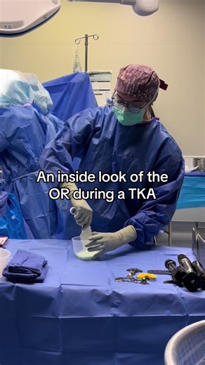 Have you ever wondered what happens in a total knee replacement? Well here ya go! 🩻🦴🩸 Before you ask: Yes, I did get permission from the surgeon to get this video. No rules or policies were broken, including HIPAA. Hoods are not a requirement by AORN guidelines. (I personally do prefer a hood though). #surgery #surgerytiktok #orthopedics #surgicaltechnologist #scrubtech