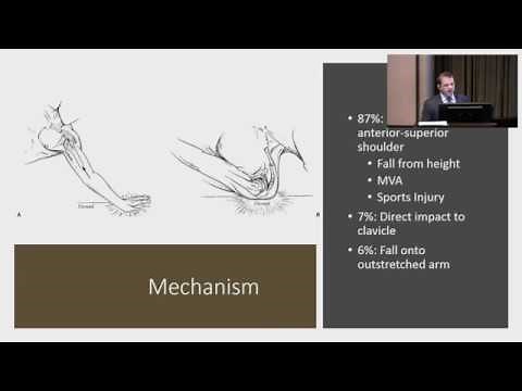 Diagnosis and Management of Shoulder Fractures: Craig Wright, MD