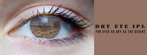 IPL Dry Eye Treatment
