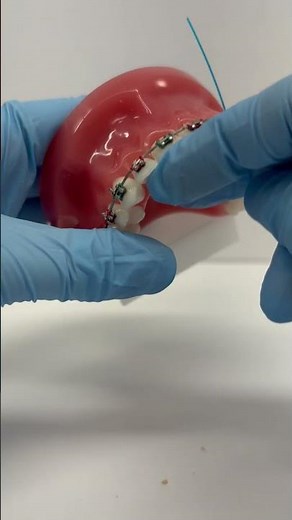 3 Ways to Floss with Braces