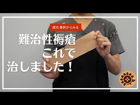 #81 難治性褥瘡これで治しました！