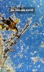 Under the Microscope: Microbes, Rotifers & Tiny Shrimp Revealed!