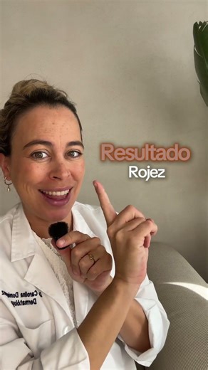 ¿Usás retinol? Esto es lo que no deberías hacer.