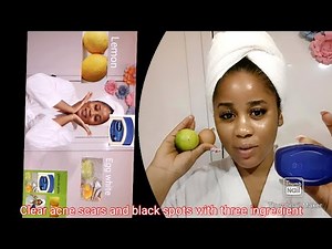 LOOK FOREVER 16 !! Using Vaseline, Lemon and egg WHITE . BABY FACE