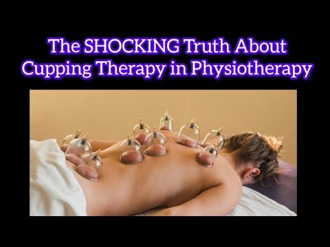 The SHOCKING Truth About Cupping Therapy in Physiotherapy