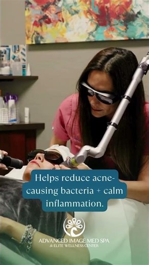 Active acne can be frustrating, but clear, calmer skin is possible!
