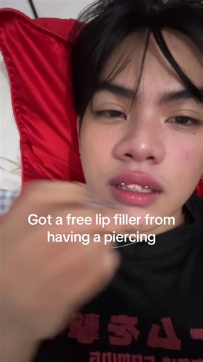 Transforming Piercing Trends: Duck-Look Lip Filler