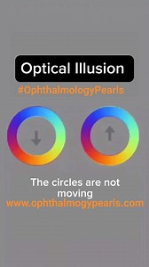 6K views · 29 reactions | An #optical #illusion/#visual illusion is a visual perception that differs from #reality. Illusions come in a wide variety; their categorization is difficult because the underlying cause is often not clear. #OphthalmologyPearls | Ophthalmology Pearls | Facebook