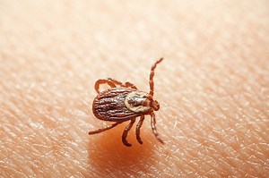 First Aid Guide for Tick Removal | Emergency Live