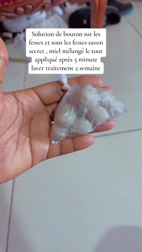 Comment éliminer les boutons de fesses efficacement