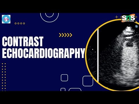Contrast Echo- Contrast usage/Echocardiography/SNSINSTITUTIONS
