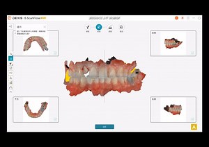 「IS ScanFlow 功能小百科」：檢查＆快照 『口掃後有沒有能幫助醫患溝通的影像呢？』 IS ScanFlow內建快照功能 一鍵點選即可享有四方位的彩色照片 有效提供醫患溝通！ 👆點擊影片了解更多吧～ #IS_ScanFlow功能小百科 @YouTube ❝ 快照 Snapshot ❞ https://youtu.be/zfoNuYzPRHA ▼IS ScanFlow功能小百科影片播放清單▼ https://bit.ly/3DlgXhu_IS_ScanFlow #DEXIS #IS3800W #無線口掃機 ＃無線口掃機讚 #NobelBiocare #諾保科 #台灣諾保科 #口掃機 | Nobel Biocare