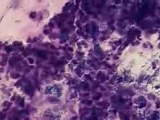 Phagocytosis • Video • MEDtube.net
