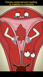 5.2M views · 16K reactions | #female #endometriosis #inability #conceive #foryou #fypシ #sciencefacts #mathematics#physics#life #subject #science #quantumphysics, #fyp #foryou #tiktok #lnteresting#science#physics | Sience | Facebook