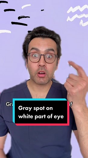 Understanding Gray Spot on White Part of Eye: Causes and Treatment