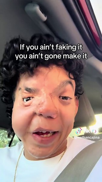 Making Lemonade: Humor and Resilience in Life