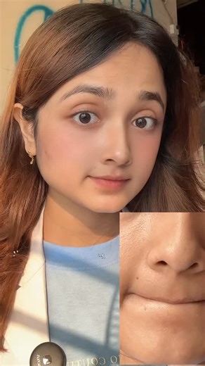 Blackheads , Bumpy Chins and Large open Pores Problem! SOLUTION IN 5/10 minutes with this MEDICUBE CLAY MASK ! (WiTH Proof in the Video) #reels #skincare #skin #viral #beauty #trending #health #pores #blackheads | Mehejabin Hossain Medha