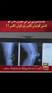 1.1K views · 63 reactions | Technical Sharafat on Reels | Facebook