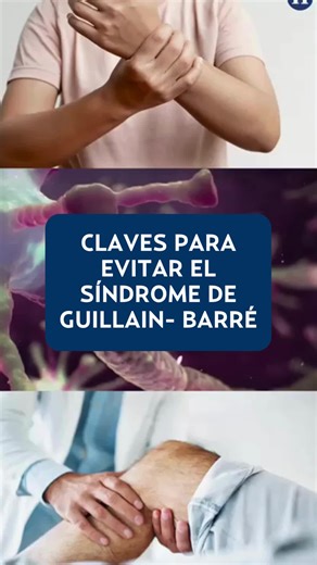 Claves para Evitar el Síndrome de Guillain-Barré