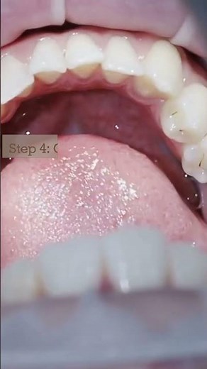 5 Tips to Eating with Dentures