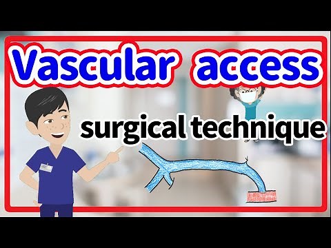 Vascular access ⭐️（Arteriovenous fistula）