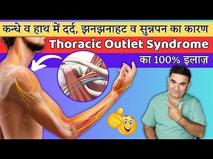 Thoracic Outlet Syndrome | Thoracic Outlet Syndrome Exercises #thoracicoutletsyndrome