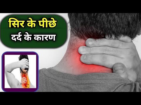 Sir ke back side dard hona | Sir ke piche dard hone ka karan