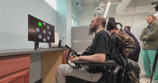 Colorado surgery first to implant higher-level brain computer interface
