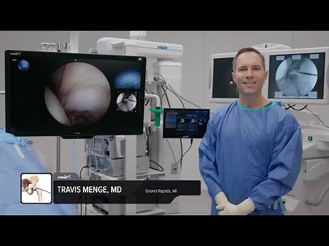 Hip Labral Repair and Cam Resection Using Dual-View Imaging With the Synergy Vision™ System