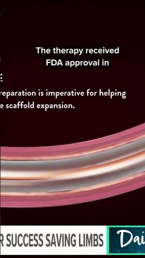 University Hospitals study shows promise for patients facing amputation