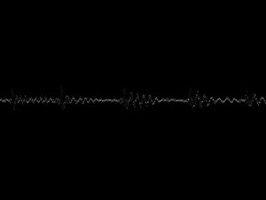 The cranial capacity of modern man is... | Filo