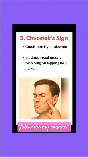 #Chvostek's Signs #Cullen's Signs #Troisier's Sign #Nursing Education Hub_e1y😘💯🔥