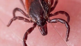 Tick talk: What you need to know about ticks and tick-borne diseases