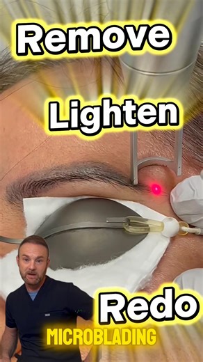 Microblading Removal Explained in 60 Seconds.