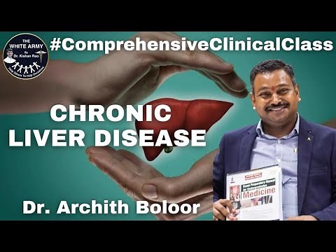 Chronic Liver Disease Case Presentation