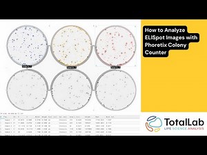 How to Analyze ELISpot Images with Phoretix Colony Counter