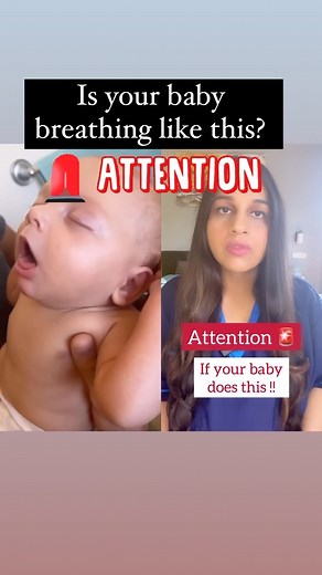Dr.Sanchi Rastogi | Faster breathing and chest retractions are two most important signs suggesting respiratory distress. This can happen in cases of... | Instagram