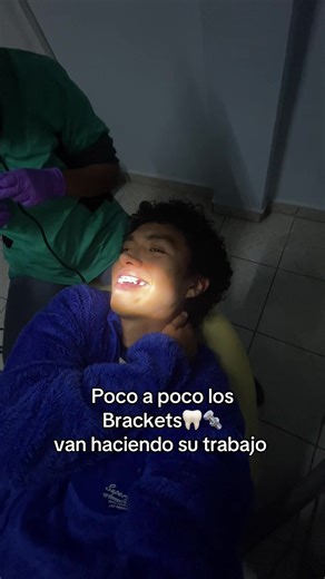 4 Meses con Brackets: Transformando Sonrisas