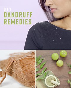 1.9M views · 3.7K reactions | 3 easy DIY Home Remedies to bid goodbye to stubborn DANDRUFF! | Glamrs | Facebook