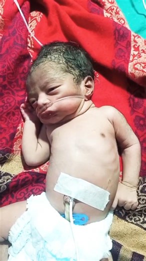 Newborn Baby Having Seizures 😢 | Baby on Oxygen Support in NICU 👶❤️ #NewbornCare #BabySeizures #NICU