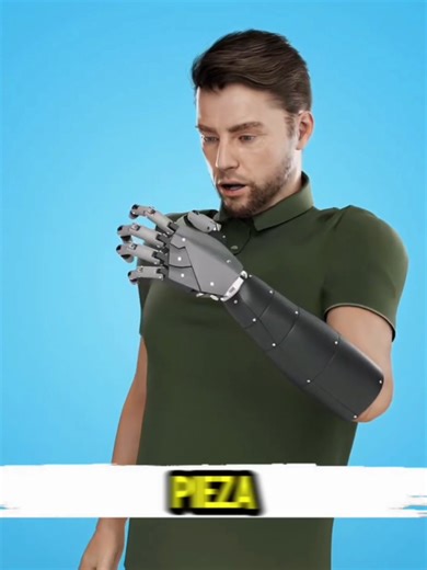 Inspiring Story of Resilience: A Man Who Lost His Arm