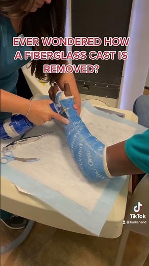 How is a fiberglass cast removed?