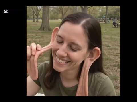 6 Terrifying Human Mutations Caught on Camera | Real Documentary