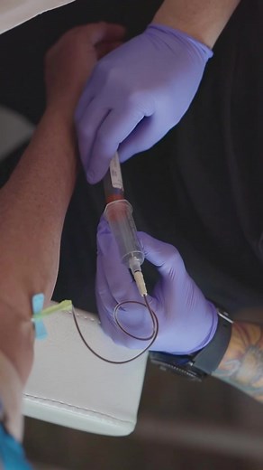 Platelet-Rich Plasma (PRP) microneedling is a popular cosmetic...