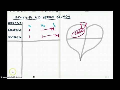 Splitting of the Heart Sounds