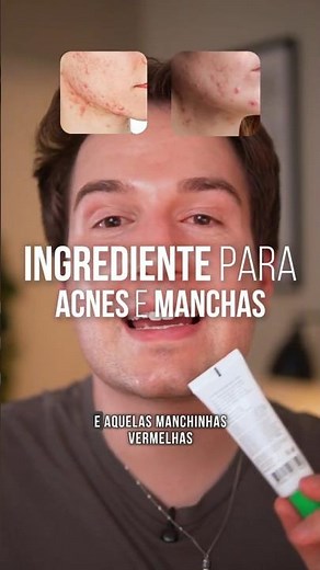 Acne and Dark Spot Treatment #azelaic #azelaicacid #zella