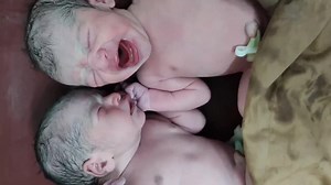 Funny Twin newborn babies after delivery talking in unique way #twins #funny #newborn #love #cute | Baby House TV