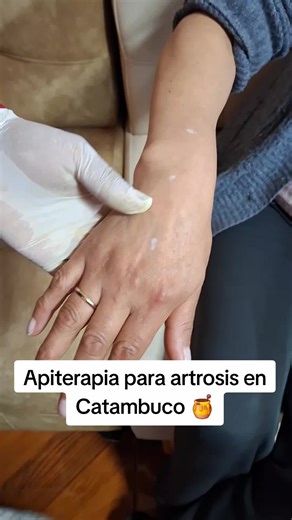 APINATURAL on TikTok