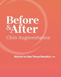 Now this result is dramatic! ✨💯 This patient received a chin implant to add projection and improve the overall balance of their facial profile. Using a special scarless technique, ASPS Member Surgeon Dr. John Diaz inserted the implant through a tiny incision inside the mouth, leaving no visible scar. Keep watching to see this life-changing transformation! #ChinAugmentation #ChinImplant #ChinSurgery #Snatched #ASPS #PlasticSurgery | American Society of Plastic Surgeons (ASPS)