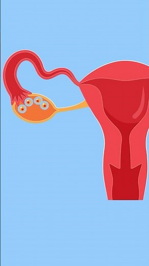 How does endometriosis affect your fertility? | Dr. Nikitha Murthy